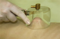 Подводно-вакуумный массаж - уникальная процедура для омоложения организма и эффективной коррекции фигуры