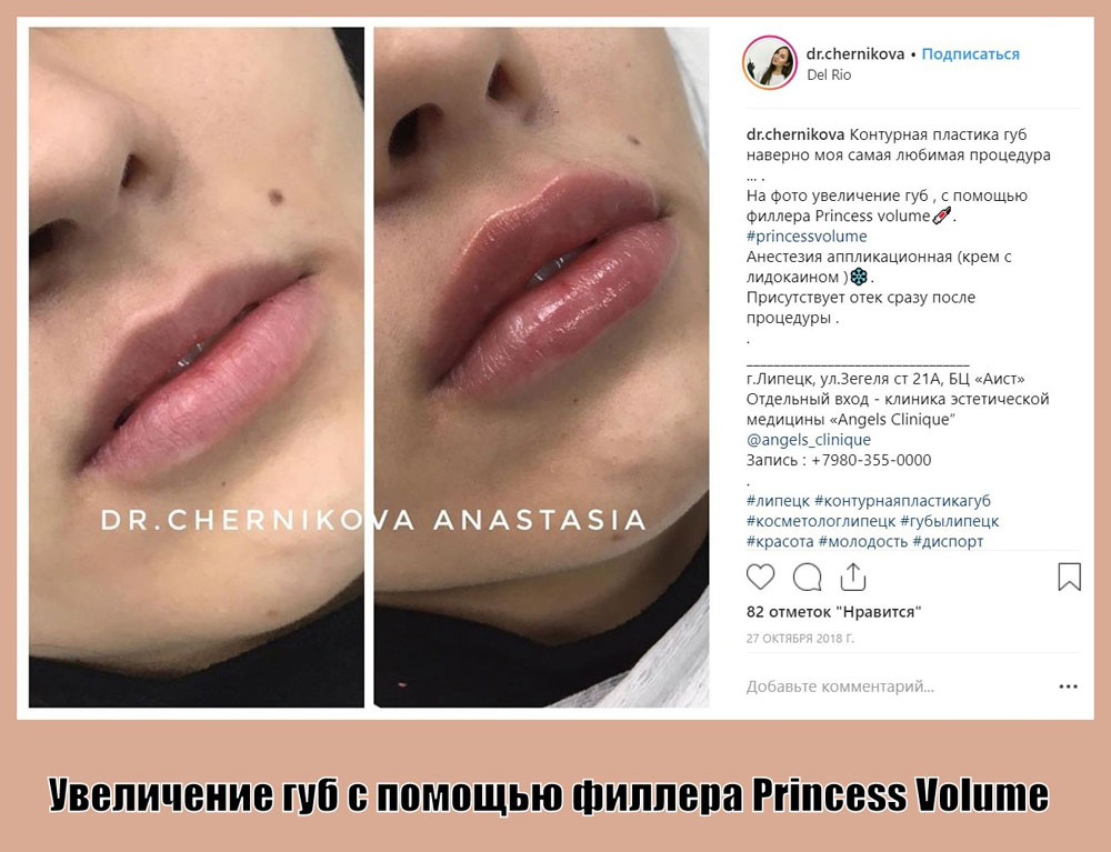 филлеры Princess